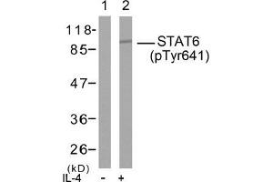 Image no. 2 for anti-Signal Transducer and Activator of Transcription 6, Interleukin-4 Induced (STAT6) (pTyr641) antibody (ABIN196700) (STAT6 antibody  (pTyr641))