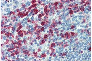 Human Spleen: Formalin-Fixed, Paraffin-Embedded (FFPE) (SELPLG antibody)
