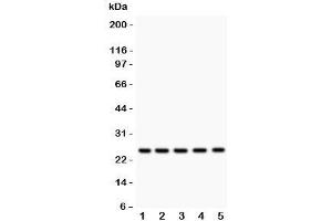 Western blot testing of HSP27 antibody and Lane 1:  rat NRK;  2: human HeLa;  3: (h) A549;  4: (h) COLO320;  5: (h) HEPG2 lysate.