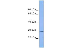 Host: Rabbit Target Name: C6orf203 Sample Type: Fetal Kidney lysates Antibody Dilution: 1. (C6ORF203 antibody  (C-Term))
