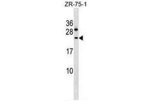 CCDC140 Antibody (N-term) western blot analysis in ZR-75-1 cell line lysates (35µg/lane). (CCDC140 antibody  (N-Term))