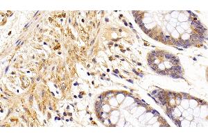 Detection of TUBb in Human Colon Tissue using Anti-Tubulin Beta (TUBb) Monoclonal Antibody (TUBB antibody  (AA 170-419))