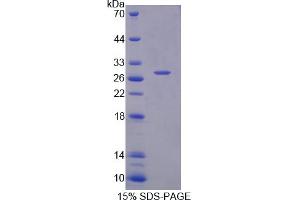 Image no. 1 for SH2B Adaptor Protein 3 (SH2B3) (AA 225-447) protein (His tag) (ABIN6238394)