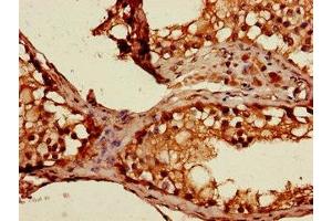 Immunohistochemistry of paraffin-embedded human testis tissue using ABIN7169663 at dilution of 1:100 (STAT1 antibody  (AA 63-196))