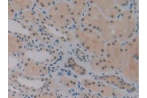 Immunohistochemistry (IHC) image for anti-DNA Fragmentation Factor, 45kDa, alpha Polypeptide (DFFA) (AA 51-305) antibody (ABIN7442849)