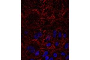 Confocal immunofluorescence analysis of U2OS cells using Septin 9 Polyclonal Antibody (ABIN6129127, ABIN6147560, ABIN6147561 and ABIN6224744) at dilution of 1:100. (Septin 9 antibody  (AA 1-110))