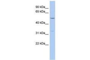Image no. 1 for anti-F-Box Protein 15 (FBXO15) (AA 71-120) antibody (ABIN6743709) (FBXO15 antibody  (AA 71-120))