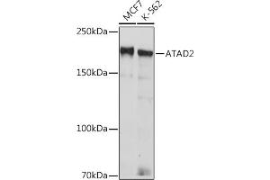 Western blot analysis of extracts of various cell lines, using  Rabbit mAb (ABIN7265749) at 1:1000 dilution. (ATAD2 antibody)