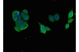 Immunofluorescent analysis of PC-3 cells using ABIN7153517 at dilution of 1:100 and Alexa Fluor 488-congugated AffiniPure Goat Anti-Rabbit IgG(H+L) (GABARAPL1 antibody  (AA 1-117))