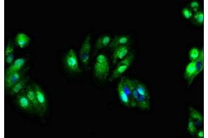 Immunofluorescent analysis of HepG2 cells using ABIN7171195 at dilution of 1:100 and Alexa Fluor 488-congugated AffiniPure Goat Anti-Rabbit IgG(H+L) (SDC4 antibody  (AA 19-145))