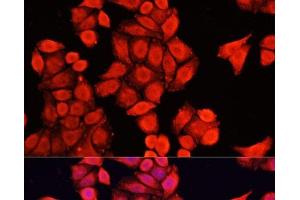 Immunofluorescence analysis of HeLa cells using NRF1 Polyclonal Antibody at dilution of 1:100.
