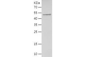Western Blotting (WB) image for PHD Finger Protein 14 (PHF14) (AA 1-292) protein (His-IF2DI Tag) (ABIN7283896) (PHF14 Protein (AA 1-292) (His-IF2DI Tag))