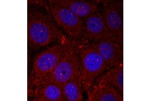 Immunofluorescence (IF) image for anti-Synuclein, alpha (SNCA) (pTyr136) antibody (ABIN1870623) (SNCA antibody  (pTyr136))