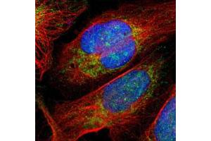Immunofluorescent staining of human cell line U-2 OS with RPS6KA6 polyclonal antibody  at 1-4 ug/mL shows positivity in nucleus, nucleoli & mitochondria. (RPS6KA6 antibody)