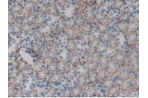 Immunohistochemistry (IHC) image for anti-Integrin alpha D (ITGAD) (AA 879-1099) antibody (ABIN7442624)