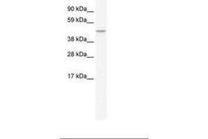 Image no. 1 for anti-Transmembrane Protein 108 (TMEM108) (C-Term) antibody (ABIN203178) (TMEM108 antibody  (C-Term))