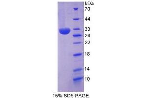 SDS-PAGE (SDS) image for Inter-alpha Globulin Inhibitor H2 Polypeptide (ITIH2) (AA 452-702) protein (His tag) (ABIN2125347)