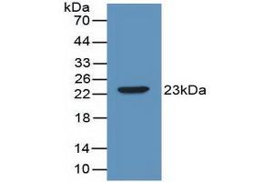 Western blot analysis of recombinant Mouse IL2. (IL-2 antibody  (AA 10-169))