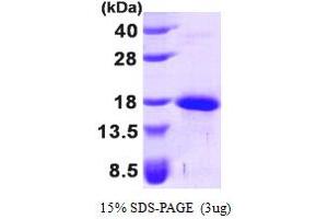SDS-PAGE (SDS) image for Growth Differentiation Factor 5 (GDF5) (AA 382-501) protein (His tag) (ABIN666773) (GDF5 Protein (AA 382-501) (His tag))