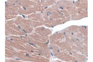 Detection of ITGa3 in Mouse Heart Tissue using Polyclonal Antibody to Integrin Alpha 3 (ITGa3)