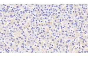 Detection of IDS in Human Liver Tissue using Polyclonal Antibody to Iduronate-2-Sulfatase (IDS) (IDS antibody  (AA 95-289))