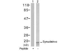 Image no. 1 for anti-Synuclein, alpha (SNCA) (Tyr125) antibody (ABIN197502) (SNCA antibody  (Tyr125))