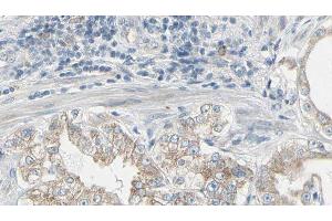 ABIN6277958 at 1/100 staining Human prostate tissue by IHC-P.