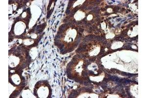 Image no. 4 for anti-NADH Dehydrogenase (Ubiquinone) Complex I, Assembly Factor 7 (NDUFAF7) antibody (ABIN1499667) (NDUFAF7 antibody)