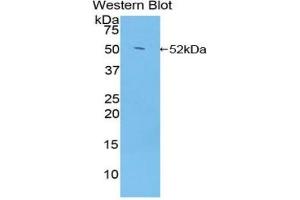Western blot analysis of the recombinant protein. (Glucocorticoid Receptor antibody  (AA 564-733))