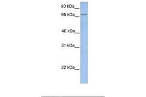 Image no. 1 for anti-Acyl-CoA Synthetase Long-Chain Family Member 1 (Acsl1) (AA 74-123) antibody (ABIN6737693) (ACSL1 antibody  (AA 74-123))