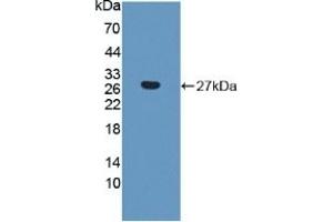 Detection of Recombinant CTHRC1, Human using Polyclonal Antibody to Collagen Triple Helix Repeat Containing Protein 1 (CTHRC1) (CTHRC1 antibody  (AA 31-243))