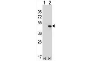 Western blot analysis of EIF4A2 (arrow) using rabbit polyclonal EIF4A2 Antibody (C-term) .
