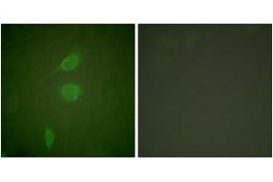 Immunofluorescence analysis of NIH-3T3 cells, using HDAC5 Antibody. (HDAC5 antibody  (AA 1073-1122))