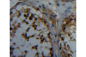 Used in DAB staining on fromalin fixed paraffin-embedded testis tissue (PAG1 antibody  (AA 138-357))