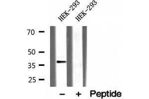 Western blot analysis of extracts of HEK-293 cells, using CLTA antibody.