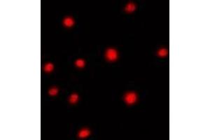 Immunofluorescent analysis of SUR2 staining in Hela cells.