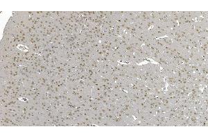 IHC analysis of DDX1 using anti-DDX1 antibody (ABIN7602051). (DDX1 antibody  (AA 562-740))