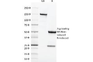SDS-PAGE Analysis Purified CD71 Mouse Monoclonal Antibody (TFRC/1818).