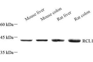 Western blot analysis of RCL1 (ABIN7075482) at dilution of 1: 500