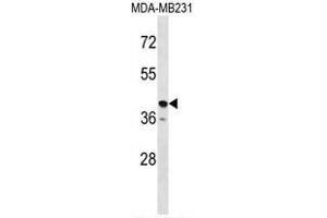 TAS2R31 Antibody (C-term) western blot analysis in MDA-MB231 cell line lysates (35µg/lane). (TAS2R31 antibody  (C-Term))