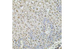 Immunohistochemistry of paraffin-embedded human esophagus using TMC1 antibody (ABIN5996250) at dilution of 1/100 (40x lens). (TMC1 antibody)