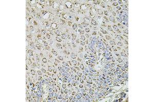 Immunohistochemistry of paraffin-embedded human esophagus using TMC1 antibody (ABIN5996250) at dilution of 1/100 (40x lens).