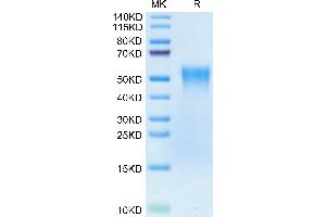 SDS-PAGE (SDS) image for Tumor Necrosis Factor Receptor Superfamily, Member 1B (TNFRSF1B) (AA 23-257) protein (His tag,Biotin) (ABIN7275761)