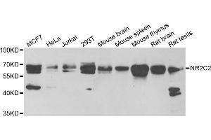 Western blot analysis of extracts of various cell lines, using NR2C2 antibody (ABIN5973822) at 1/1000 dilution. (TR4 antibody)