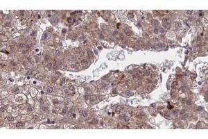 Immunohistochemistry (IHC) image for anti-Olfactory Receptor, Family 1, Subfamily J, Member 4 (OR1J4) (C-Term) antibody (ABIN6259523)