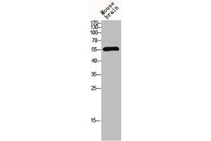 Western blot analysis of mouse-brain lysis using MMP-13 antibody. (MMP13 antibody  (N-Term))