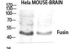 Western Blot (WB) analysis of specific cells using Fusin Polyclonal Antibody.