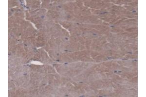 IHC-P analysis of Mouse Skeletal muscle Tissue, with DAB staining. (FPGS antibody  (AA 210-439))