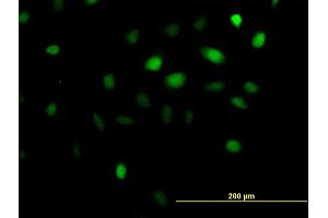 Immunofluorescence of purified MaxPab antibody to ANKRD1 on HeLa cell.