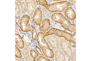 Immunohistochemistry of paraffin-embedded rat spleen using IFN Rabbit pAb (ABIN3015552, ABIN3015553, ABIN1680393 and ABIN6218813) at dilution of 1:100 (40x lens). (IFNAR1 antibody  (AA 28-290))